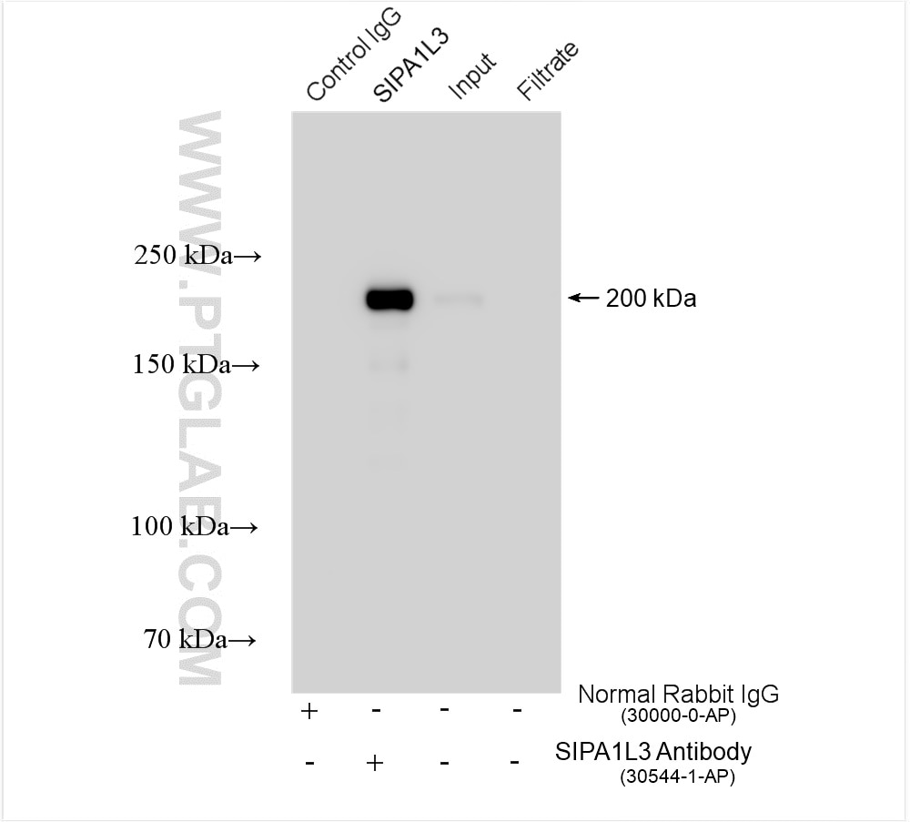 Immunoprecipitation (IP) experiment of HeLa cells using SIPA1L3 Polyclonal antibody (30544-1-AP)
