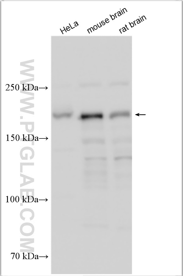 Western Blot (WB) analysis of various lysates using SIPA1L3 Polyclonal antibody (30544-1-AP)