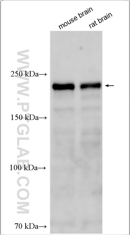 Western Blot (WB) analysis of various lysates using SIPA1L3 Polyclonal antibody (30544-1-AP)