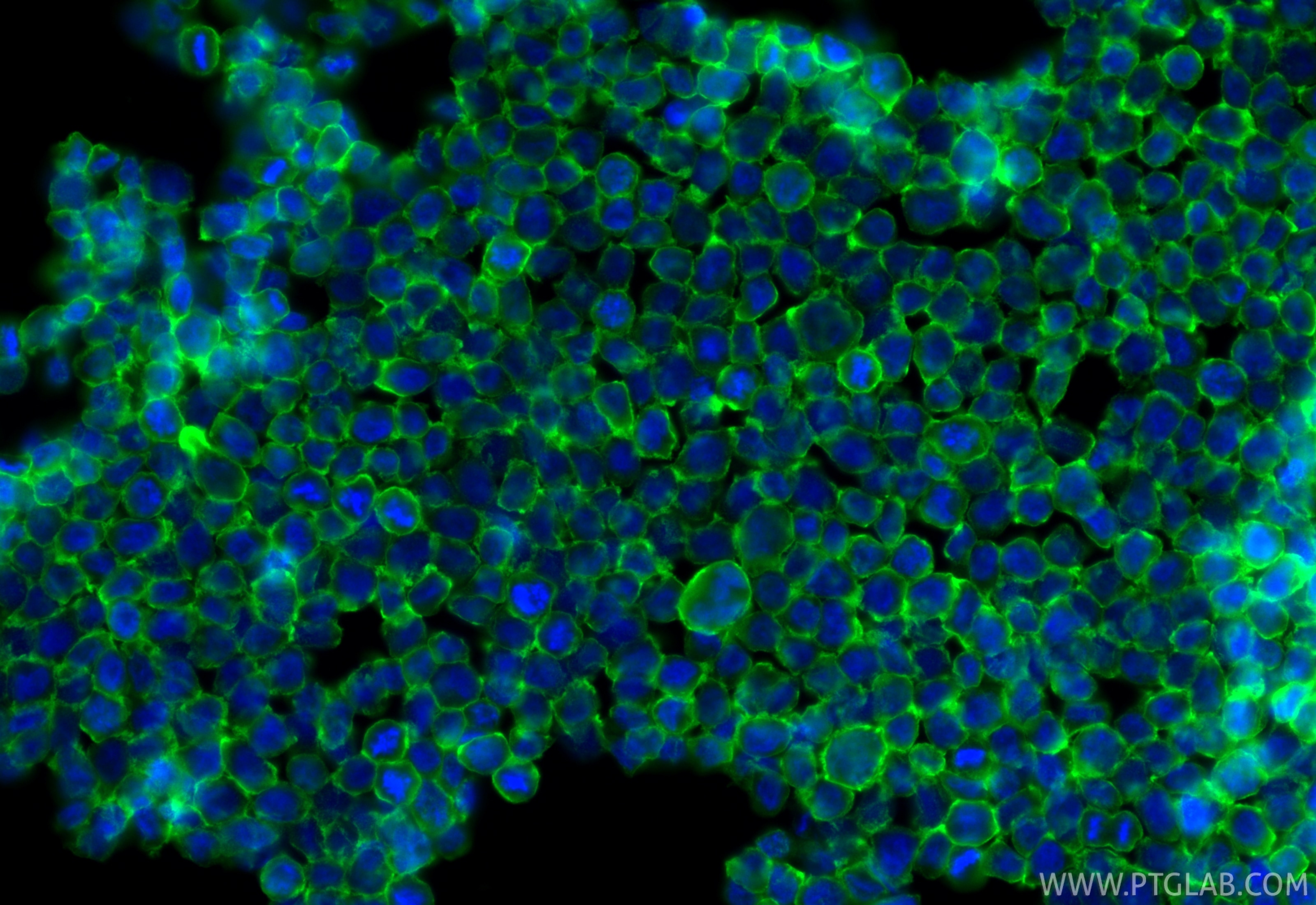 Immunofluorescence (IF) / fluorescent staining of THP-1 cells using SIRP Alpha/CD172a Polyclonal antibody (31485-1-AP)