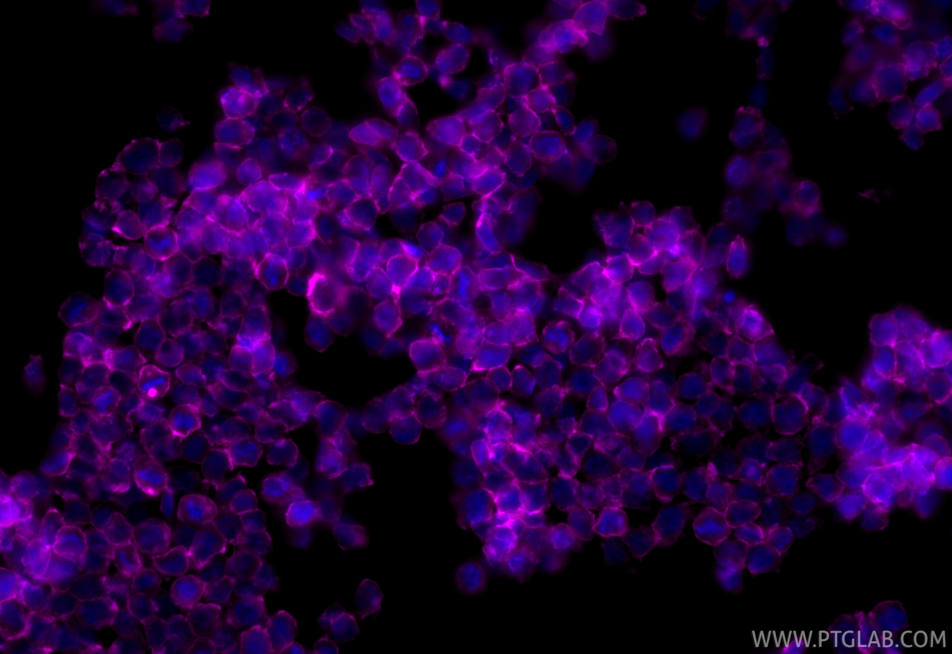 Immunofluorescence (IF) / fluorescent staining of THP-1 cells using CoraLite® Plus 647-conjugated SIRP Alpha/CD172a Po (CL647-31485)