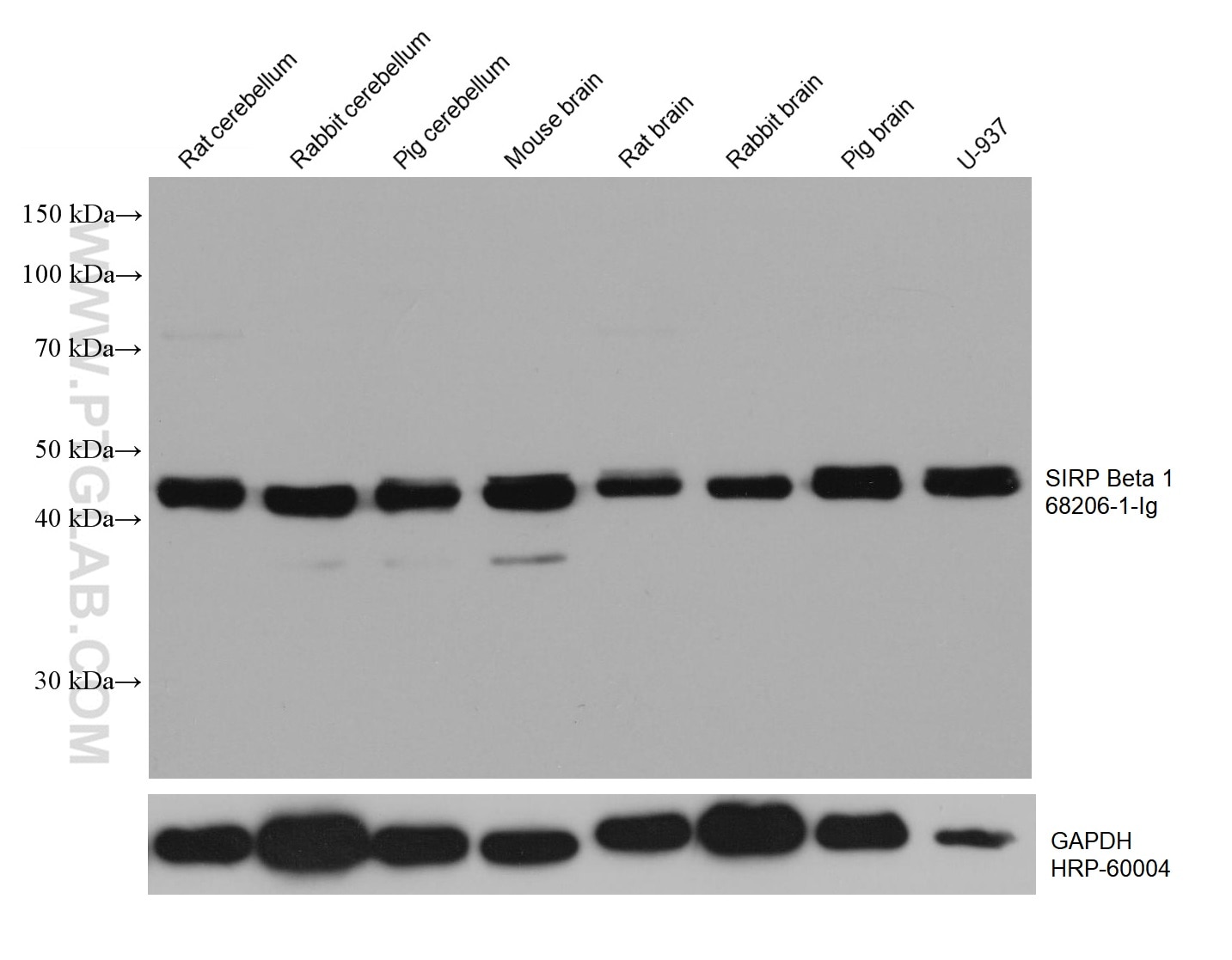Western Blot (WB) analysis of various lysates using SIRP Beta 1 Monoclonal antibody (68206-1-Ig)