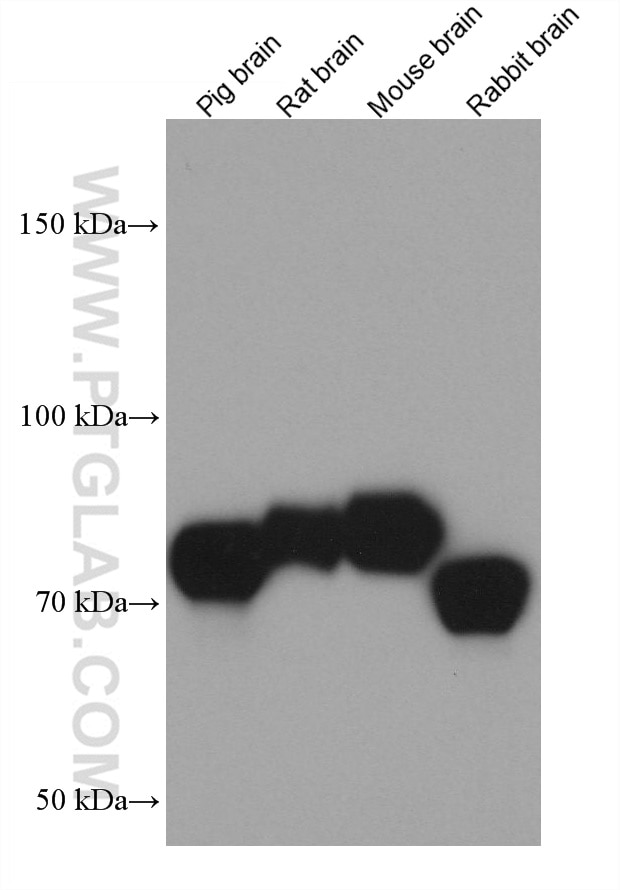 Western Blot (WB) analysis of various lysates using SIRP Alpha Monoclonal antibody (67337-1-Ig)