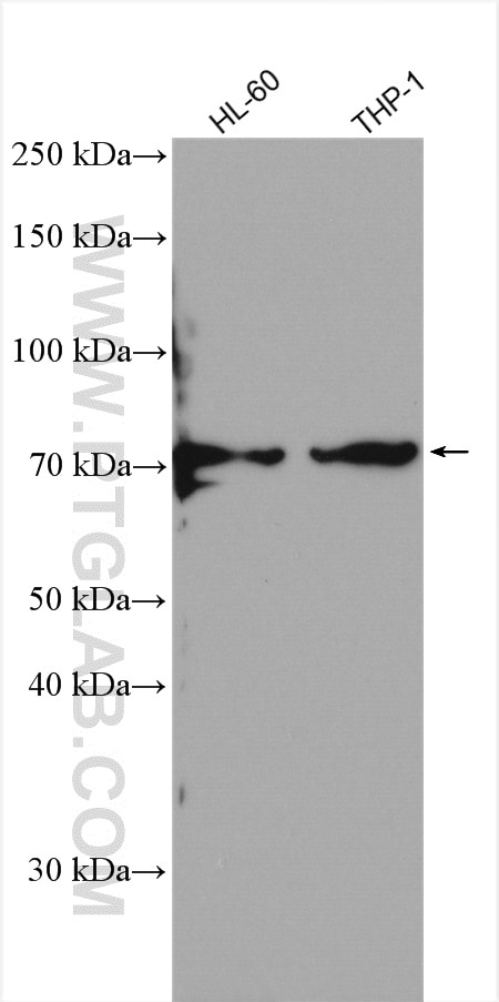 Western Blot (WB) analysis of various lysates using SIRP Alpha Polyclonal antibody (14482-1-AP)