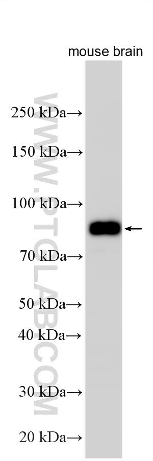 Western Blot (WB) analysis of various lysates using SIRP Alpha/CD172a Polyclonal antibody (14482-1-AP)