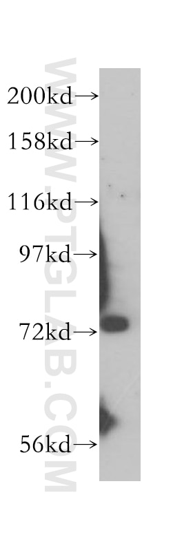 SIRP Alpha Polyclonal antibody