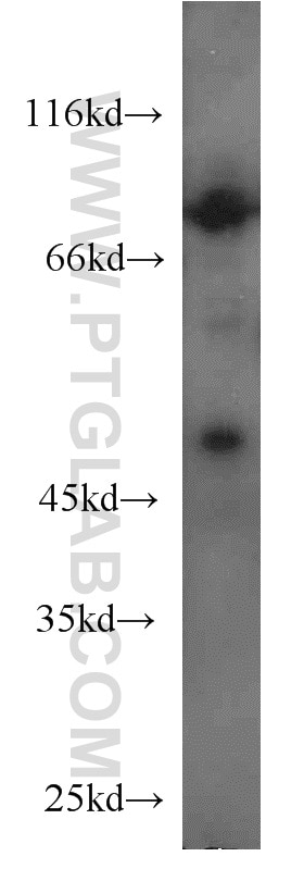 Western Blot (WB) analysis of A375 cells using SIRP Beta 1 Polyclonal antibody (11811-1-AP)