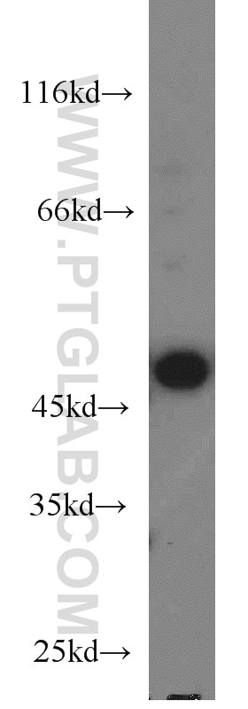 Western Blot (WB) analysis of PC-3 cells using SIRP Beta 1 Polyclonal antibody (11811-1-AP)