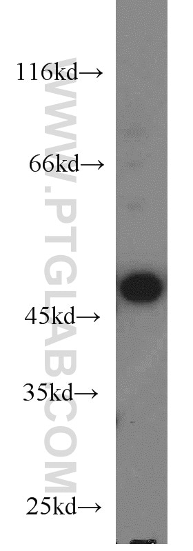 WB analysis of PC-3 using 11811-1-AP
