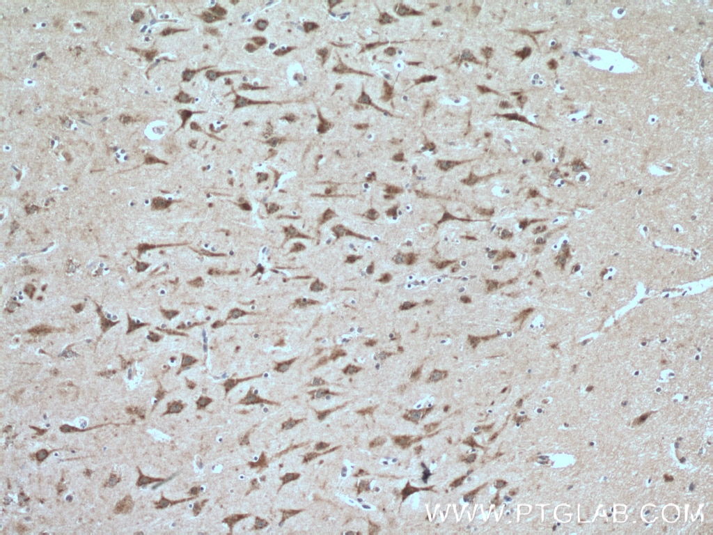 Immunohistochemistry (IHC) staining of human brain tissue using SIRPD Polyclonal antibody (26594-1-AP)