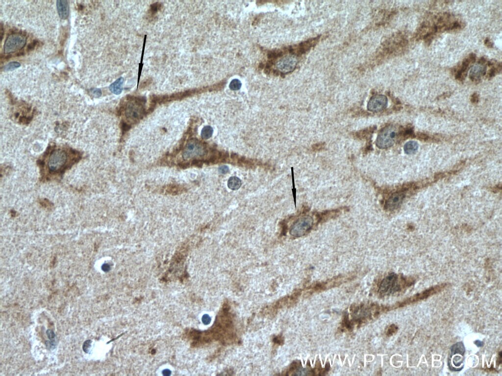 Immunohistochemistry (IHC) staining of human brain tissue using SIRPD Polyclonal antibody (26594-1-AP)