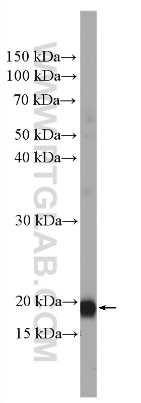 Western Blot (WB) analysis of fetal human brain tissue using SIRPD Polyclonal antibody (26594-1-AP)