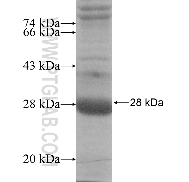 SIRPD fusion protein Ag15431 SDS-PAGE