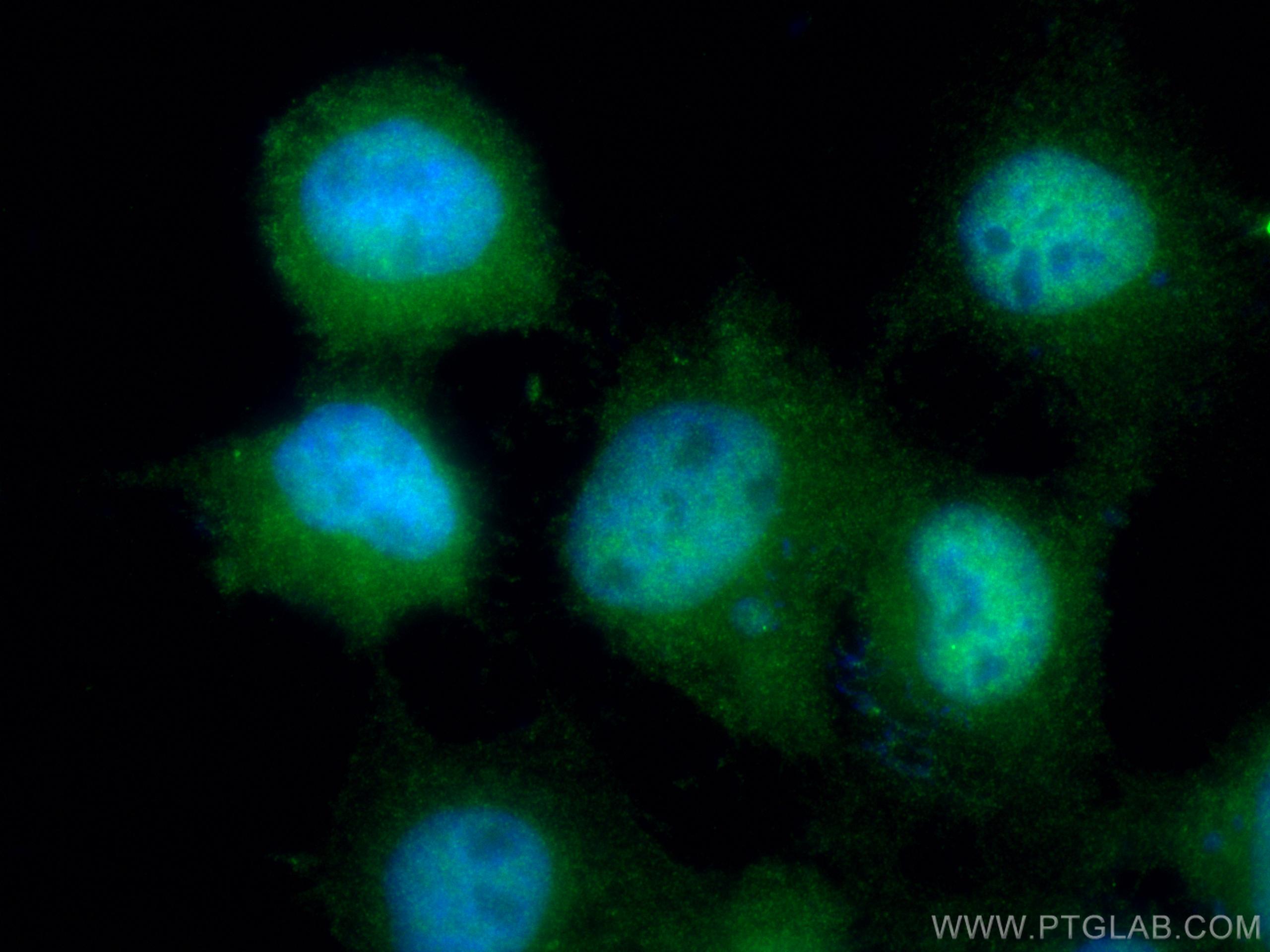 Immunofluorescence (IF) / fluorescent staining of A431 cells using SIRT1 Polyclonal antibody (13161-1-AP)