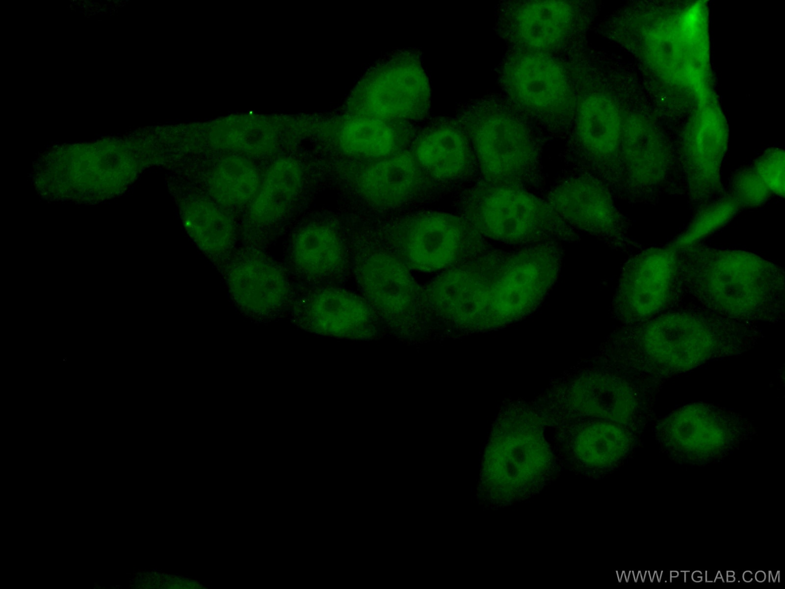 Immunofluorescence (IF) / fluorescent staining of HeLa cells using SIRT1 Polyclonal antibody (13161-1-AP)