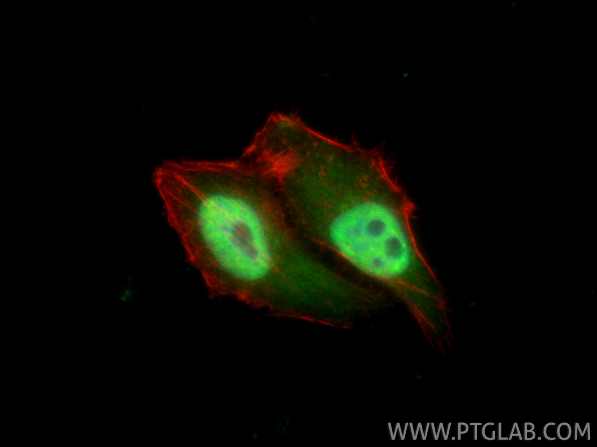 Immunofluorescence (IF) / fluorescent staining of HepG2 cells using SIRT1 Polyclonal antibody (13161-1-AP)