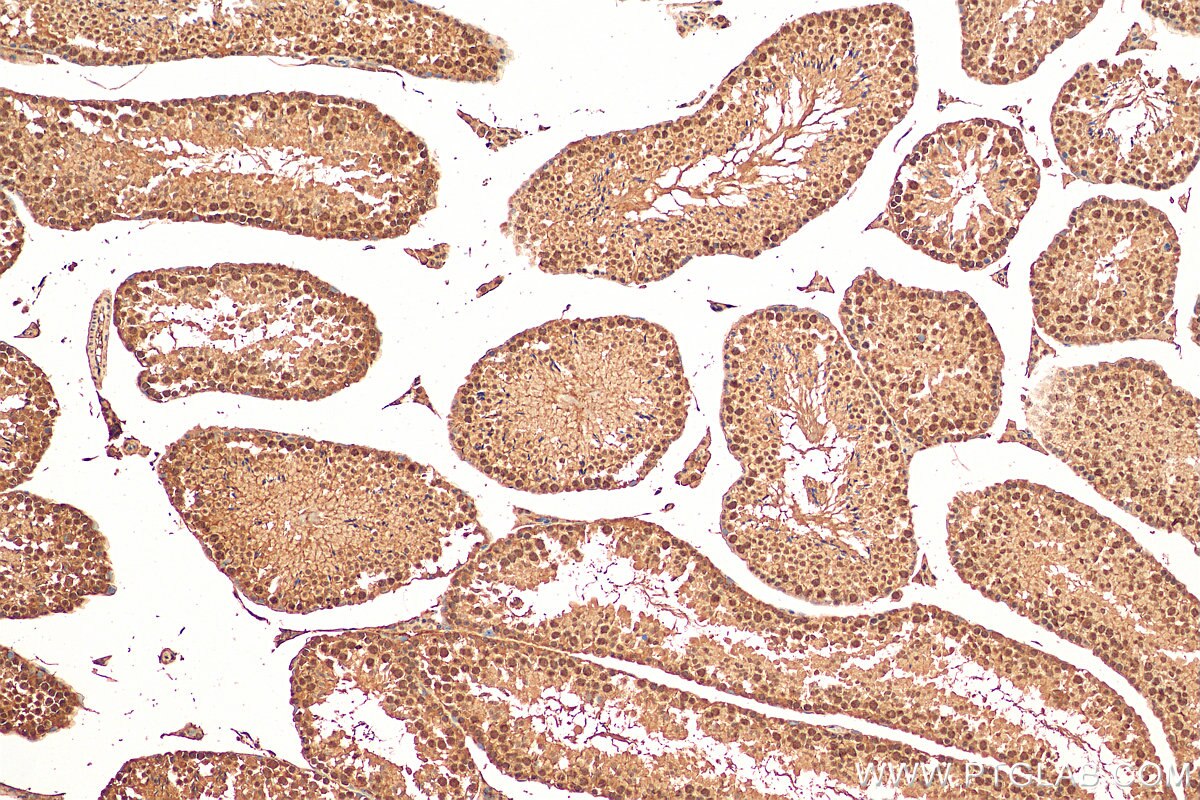Immunohistochemistry (IHC) staining of mouse testis tissue using SIRT1 Polyclonal antibody (13161-1-AP)