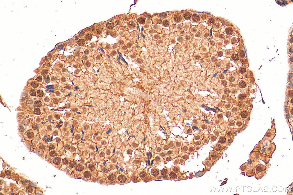 Immunohistochemistry (IHC) staining of mouse testis tissue using SIRT1 Polyclonal antibody (13161-1-AP)