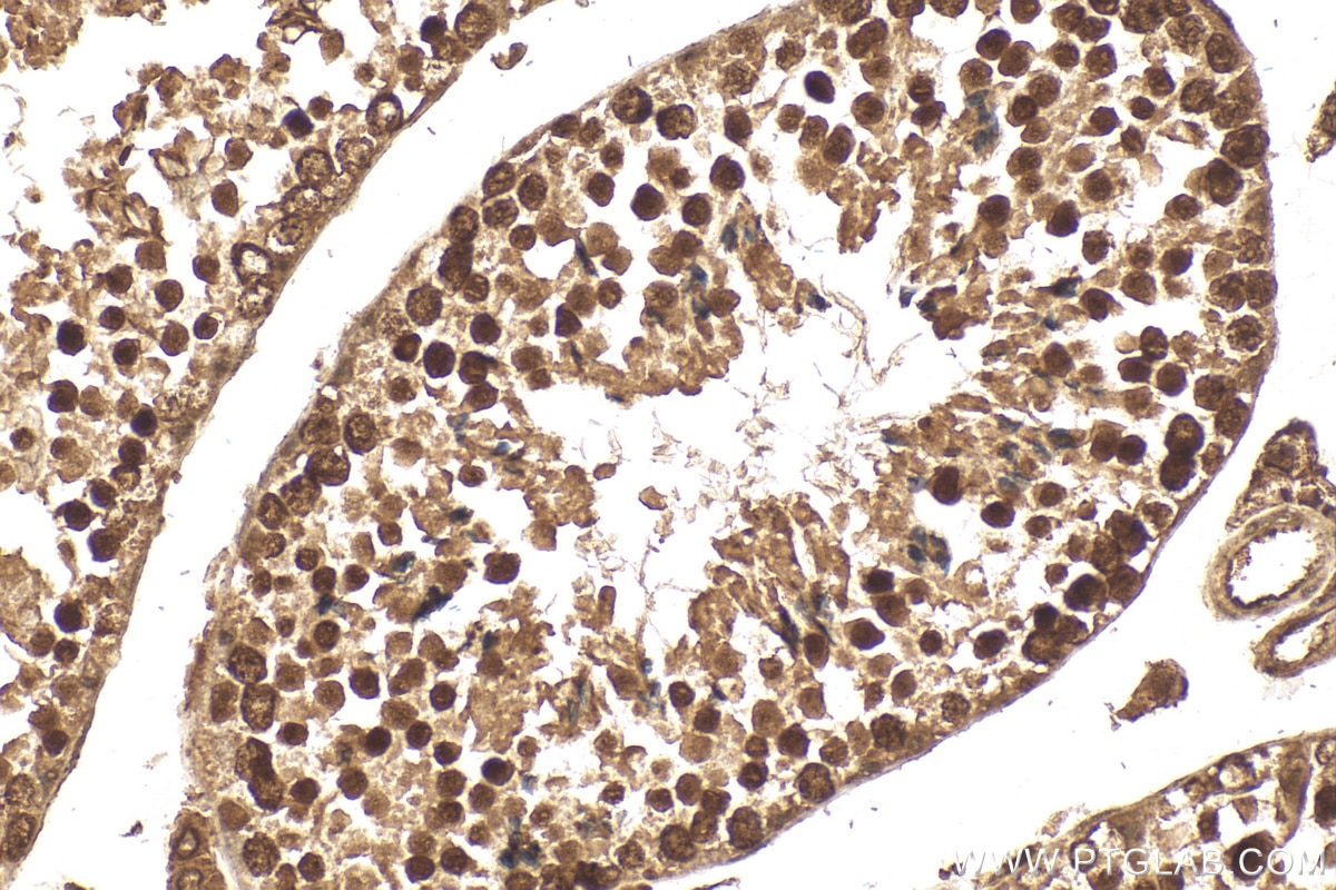 Immunohistochemistry (IHC) staining of mouse testis tissue using SIRT1 Polyclonal antibody (13161-1-AP)