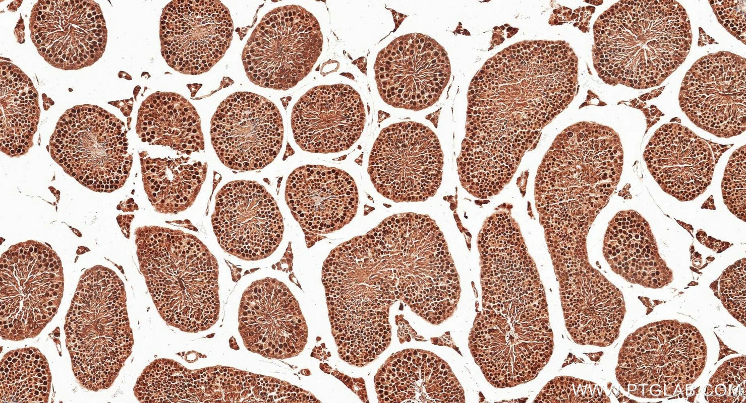 Immunohistochemistry (IHC) staining of mouse testis tissue using SIRT1 Polyclonal antibody (13161-1-AP)