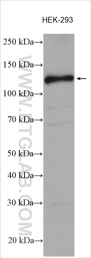 Western Blot (WB) analysis of various lysates using SIRT1 Polyclonal antibody (13161-1-AP)