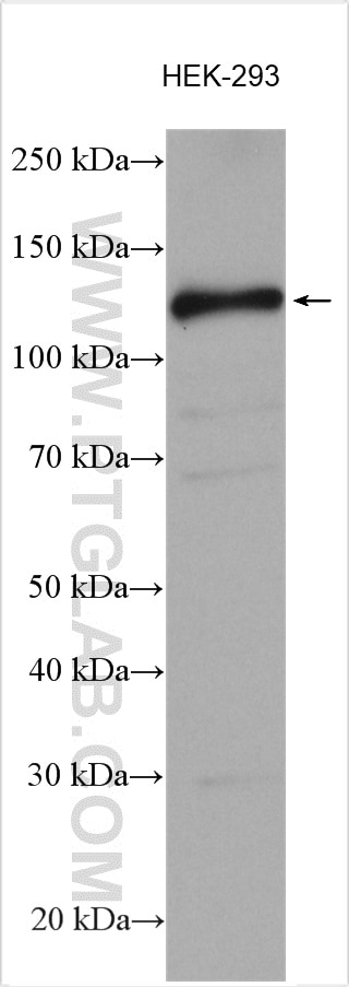 WB analysis using 13161-1-AP