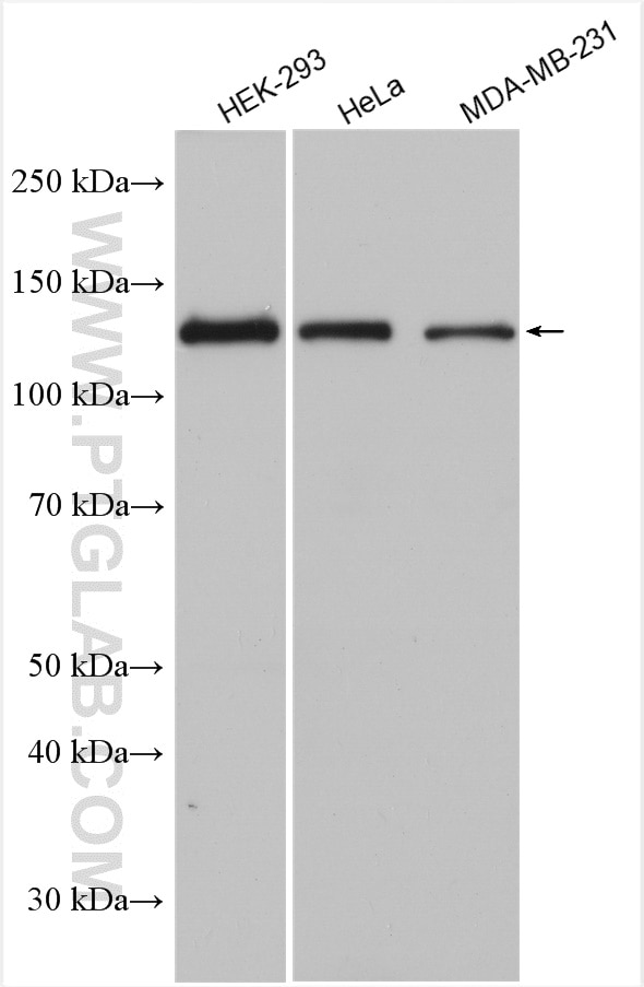 Western Blot (WB) analysis of various lysates using SIRT1 Polyclonal antibody (13161-1-AP)