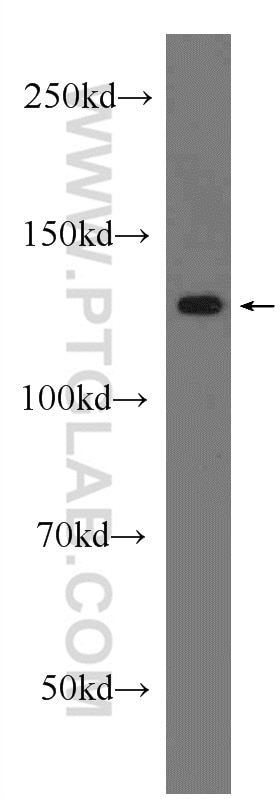 WB analysis of HeLa using 13161-1-AP