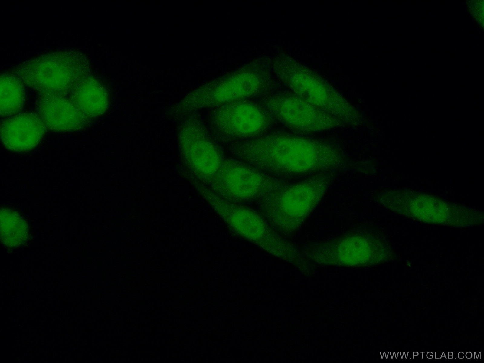 Immunofluorescence (IF) / fluorescent staining of HeLa cells using SIRT1 Monoclonal antibody (60303-1-Ig)
