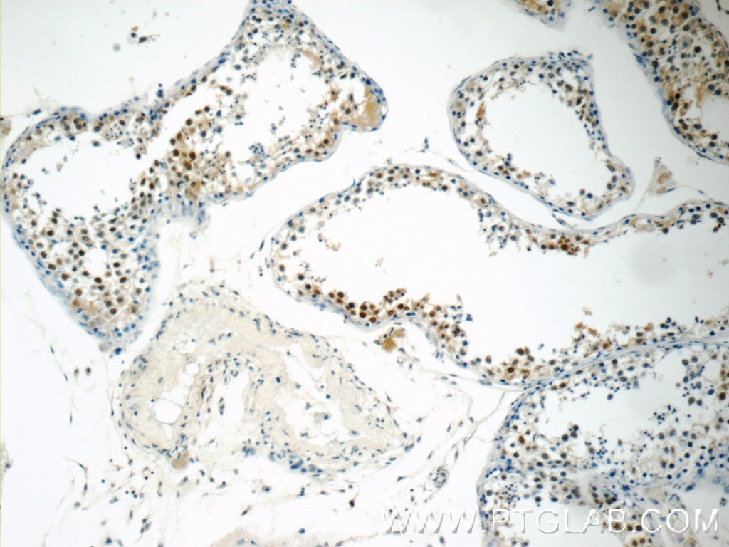 Immunohistochemistry (IHC) staining of human testis tissue using SIRT1 Monoclonal antibody (60303-1-Ig)