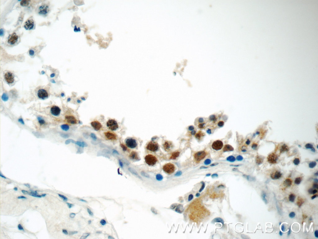 Immunohistochemistry (IHC) staining of human testis tissue using SIRT1 Monoclonal antibody (60303-1-Ig)