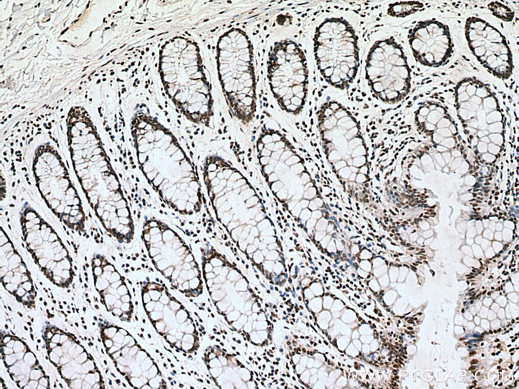 IHC staining of human colon using 60303-1-Ig