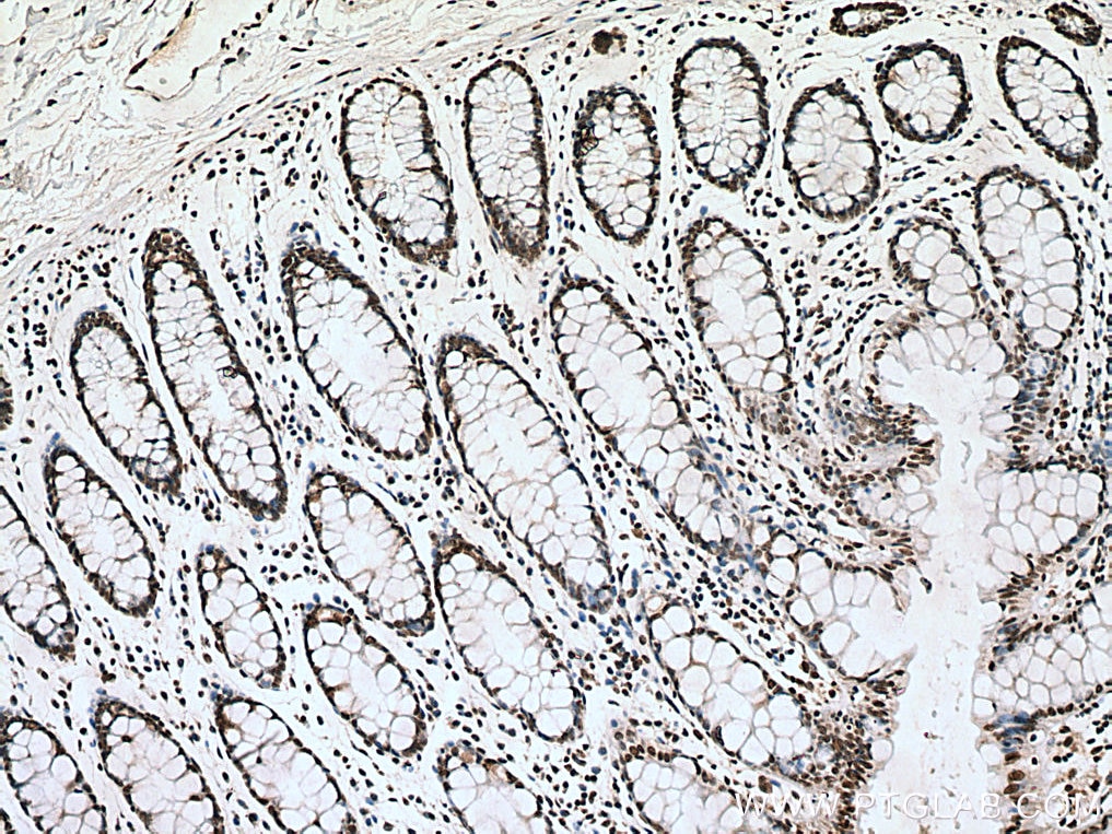 Immunohistochemistry (IHC) staining of human colon tissue using SIRT1 Monoclonal antibody (60303-1-Ig)