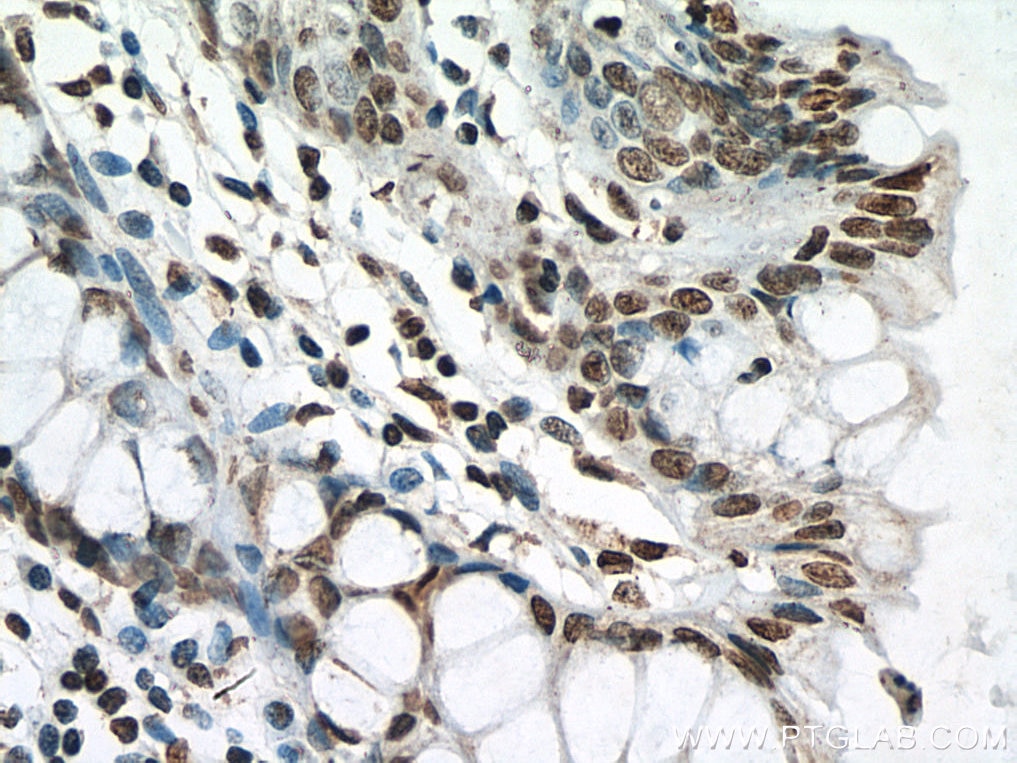 Immunohistochemistry (IHC) staining of human colon tissue using SIRT1 Monoclonal antibody (60303-1-Ig)