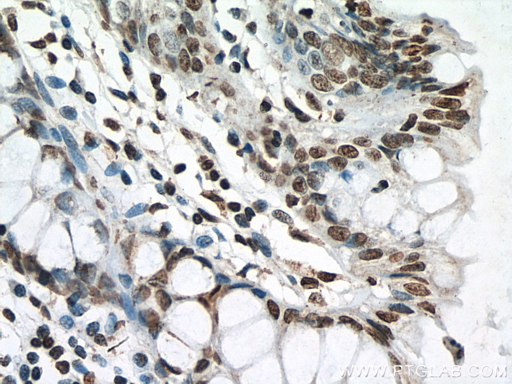 IHC staining of human colon using 60303-1-Ig