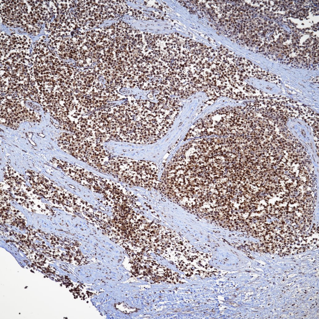 Immunohistochemistry (IHC) staining of human testis tissue using SIRT1 Recombinant monoclonal antibody (82790-4-RR)