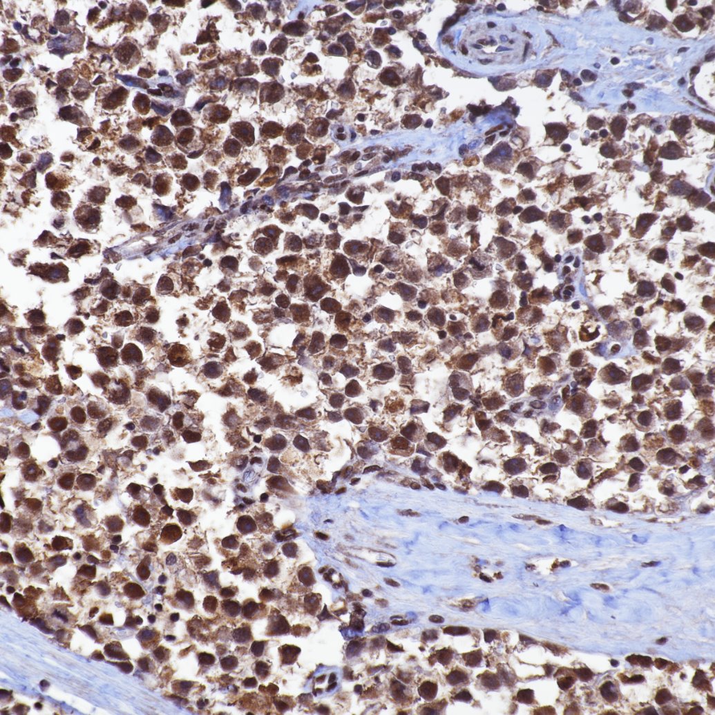 Immunohistochemistry (IHC) staining of human testis tissue using SIRT1 Recombinant monoclonal antibody (82790-4-RR)