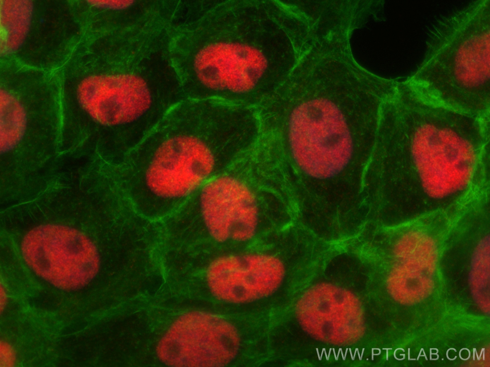 Immunofluorescence (IF) / fluorescent staining of A431 cells using Multi-rAb™ SIRT1 Multi-Recombinant antibody (RMX00009)