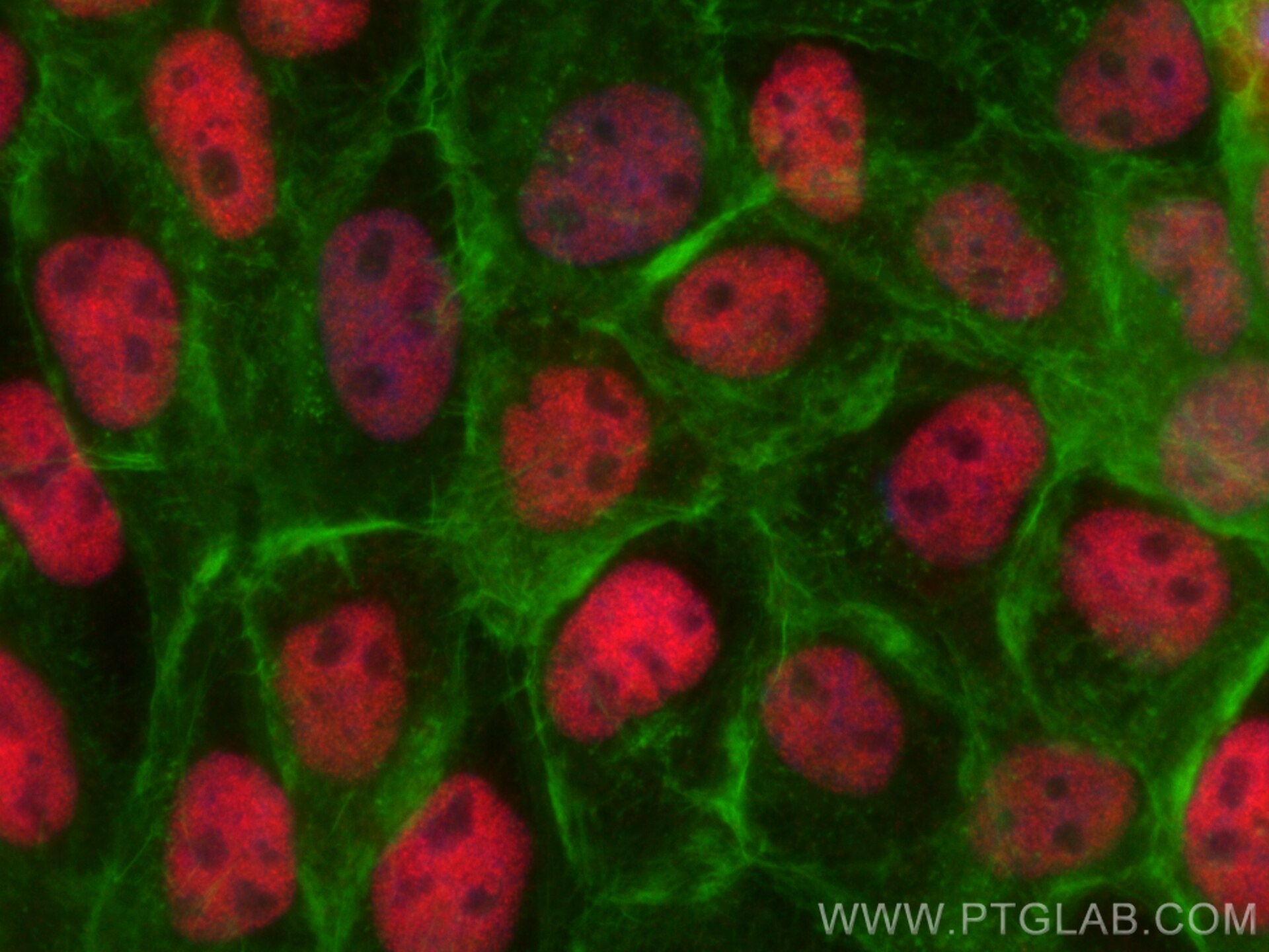 Immunofluorescence (IF) / fluorescent staining of A431 cells using Multi-rAb™ SIRT1 Multi-Recombinant antibody (RMX00009)