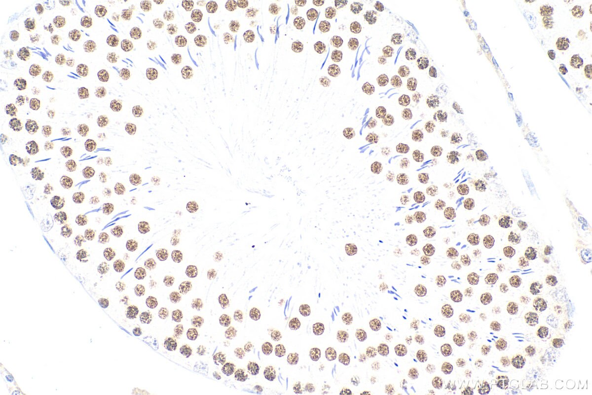 Immunohistochemistry (IHC) staining of rat testis tissue using Multi-rAb™ SIRT1 Multi-Recombinant antibody (RMX00009)