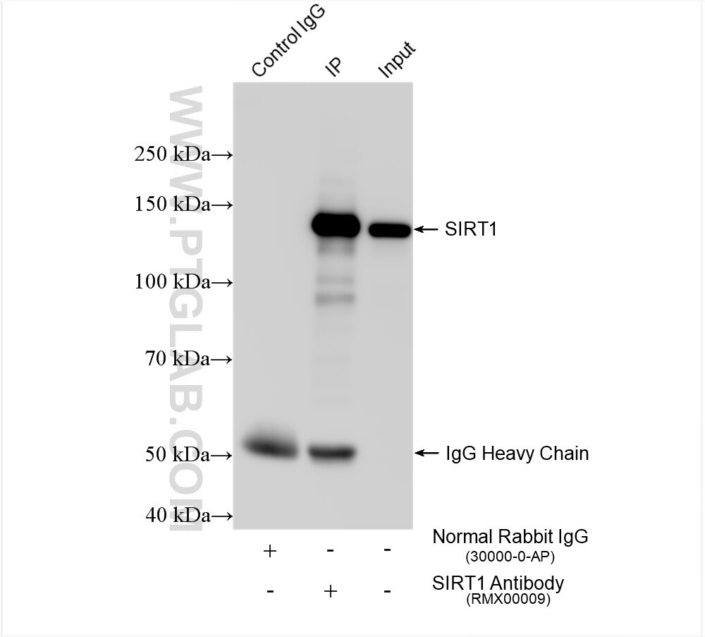 Immunoprecipitation (IP) experiment of HeLa cells using Multi-rAb™ SIRT1 Multi-Recombinant antibody (RMX00009)