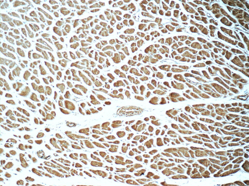 Immunohistochemistry (IHC) staining of human heart tissue using SIRT2 Polyclonal antibody (15345-1-AP)
