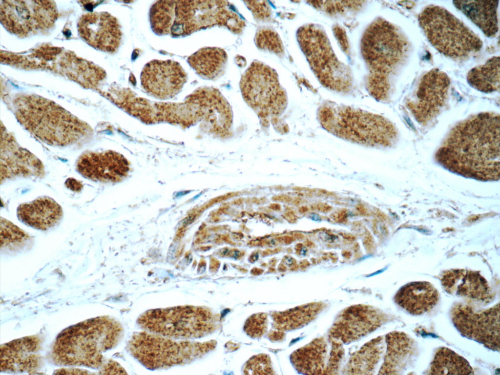 Immunohistochemistry (IHC) staining of human heart tissue using SIRT2 Polyclonal antibody (15345-1-AP)