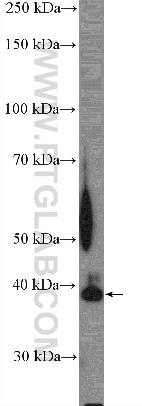 Western Blot (WB) analysis of rat kidney tissue using SIRT2 Polyclonal antibody (15345-1-AP)