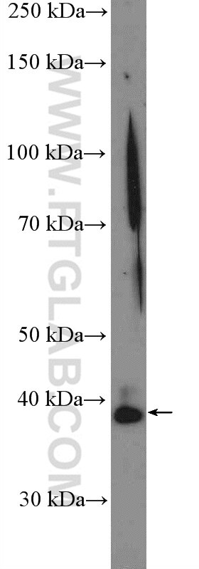 Western Blot (WB) analysis of rat kidney tissue using SIRT2 Polyclonal antibody (15345-1-AP)