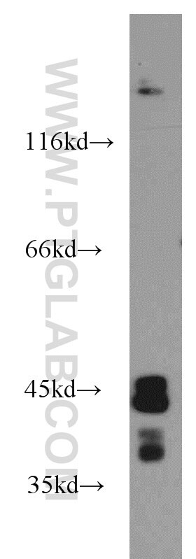 Western Blot (WB) analysis of human brain tissue using SIRT2 Polyclonal antibody (15345-1-AP)