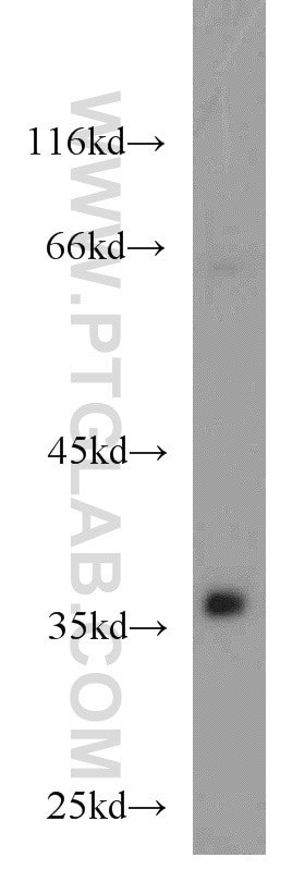 Western Blot (WB) analysis of mouse brain tissue using SIRT2 Polyclonal antibody (15345-1-AP)