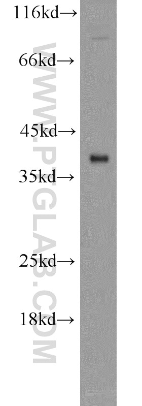 Western Blot (WB) analysis of mouse brain tissue using SIRT2 Polyclonal antibody (15345-1-AP)