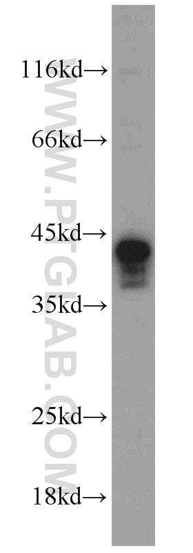 Western Blot (WB) analysis of rat kidney tissue using SIRT2 Polyclonal antibody (15345-1-AP)