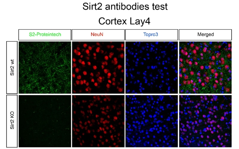 Immunofluorescence (IF) / fluorescent staining of mouse cortex using SIRT2 Polyclonal antibody (19655-1-AP)